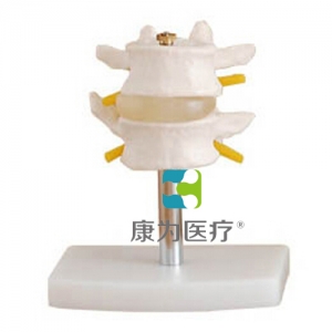 “康為醫(yī)療”正常腰椎組合 （二節(jié)）