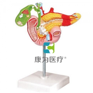 “康為醫(yī)療”病理模型胰腺模型，十二指腸和膽囊模型