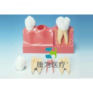 “康為醫(yī)療”牙分解模型(4倍大)