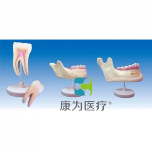 “康為醫(yī)療”磨牙、乳牙、橫牙解剖(自然大)
