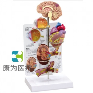 “康為醫(yī)療”醫(yī)患關(guān)系溝通模型-微型腦、眼、心、腎及動脈模型 （醫(yī)學指導模型）