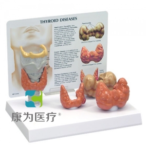 “康為醫(yī)療”細胞亞顯微結(jié)構(gòu)模型“康為醫(yī)療”醫(yī)患關(guān)系溝通模型-甲狀腺帶軟骨、氣管模型（醫(yī)學指導模型）