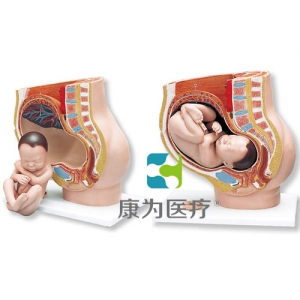 妊娠骨盆模型，3部分