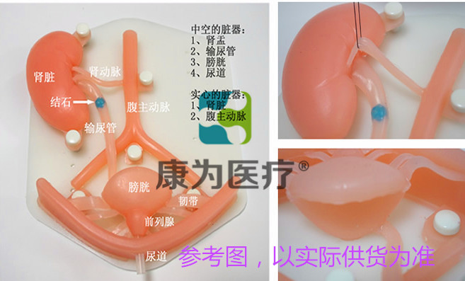 “康為醫(yī)療”泌尿科專(zhuān)用腹腔鏡手術(shù)模擬訓(xùn)練裝置